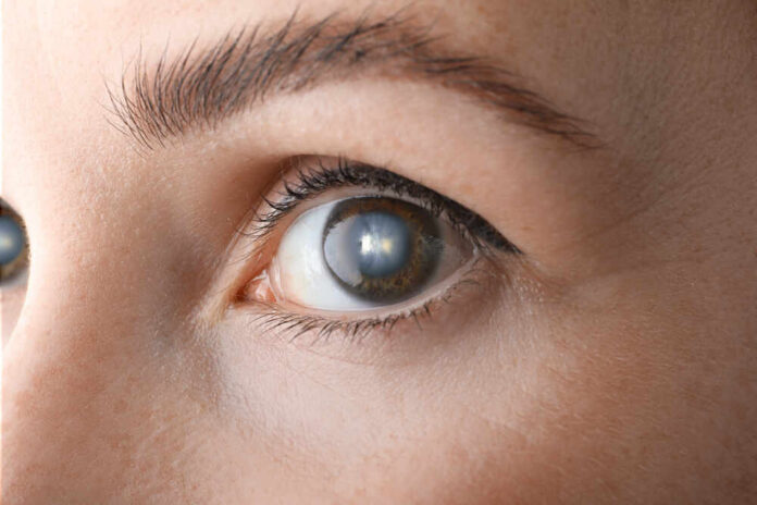 shutterstock_1994516630.jpg Close-up view of a human eye showcasing the iris and eyelashes