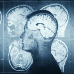Brain Fuel Discovery Reverses Cognitive Decline MRI scans of the brain displayed alongside a silhouette of a human head