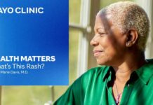 Dermatitis Explained: Eczema, Dandruff and Rashes | Mayo