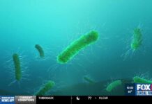 What causes vibrio vulnificus flesh-eating bacteria?