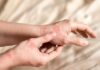 Sun Damage Repair in Weeks Close-up of a person's hands showing skin irritation and redness