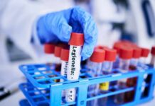 Chemical Cocktail in Blood: What Aren’t We Seeing? A gloved hand holding a test tube labeled 'Legionella' among other samples