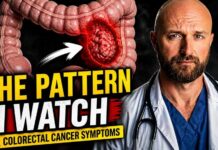 Bowel Symptoms That Could Be Cancer: What a Surgeon Actually Looks For