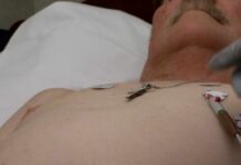 Breakthrough Badge For Life‑Saving Heart AI AI-ECG helps physicians detect hidden heart condition
