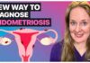 Diagnosing Endometriosis Without Surgery: New ACOG Guidelines