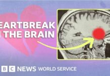 How love, pain and heartbreak rewire your brain How love and heartbreak rewire your brain - BBC World Service