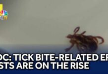 CDC Warning: Tick Surge Alarms ERs Nationwide CDC: Tick bite-related ER visits are on the rise