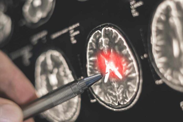 A,Doctor,Examines,An,X-ray,Of,A,Human,Brain.,Treatment A hand pointing at a brain scan with highlighted areas
