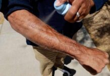 Mayo Clinic Minute - What type of sunscreen should you use?