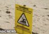 Bacteria shuts down beaches coast to coast in the U.S.