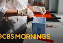 Key things to know about egg freezing