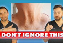 Effective Strategies for Managing and Preventing Crepey Skin How to FIX CREPEY SKIN | The Ultimate Dermatologist Guide