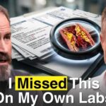 A Cardiovascular Surgeon Had a Heart Attack Here's What His Own Tests Missed