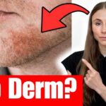 Dermatologist Explains How To Treat Seborrheic Dermatitis (Dandruff, Flaky Scalp, Eyebrows & Beard)