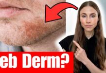 Dandruff in Beards: Causes and DIY Treatments Dermatologist Explains How To Treat Seborrheic Dermatitis (Dandruff, Flaky Scalp, Eyebrows & Beard)