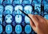 Hand pointing at brain MRI scans with a pen