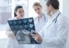 Shocking Dental Link to Cancer Longevity Doctors reviewing brain scan images together