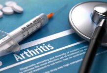 Osteoarthritis Surgery Breakthrough – New Hope For The Knee Syringe and stethoscope on arthritis document