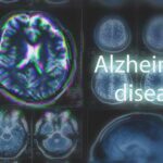 Genetic Wild Card Upends Alzheimer’s Playbook Brain MRI scans with highlighted section and text overlay