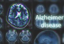 Genetic Wild Card Upends Alzheimer’s Playbook Brain MRI scans with highlighted section and text overlay