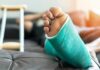 Injured foot in a turquoise cast resting on a couch