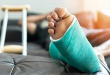 NFL’s Dreaded Pop: Comeback Odds Plummet Injured foot in a turquoise cast resting on a couch