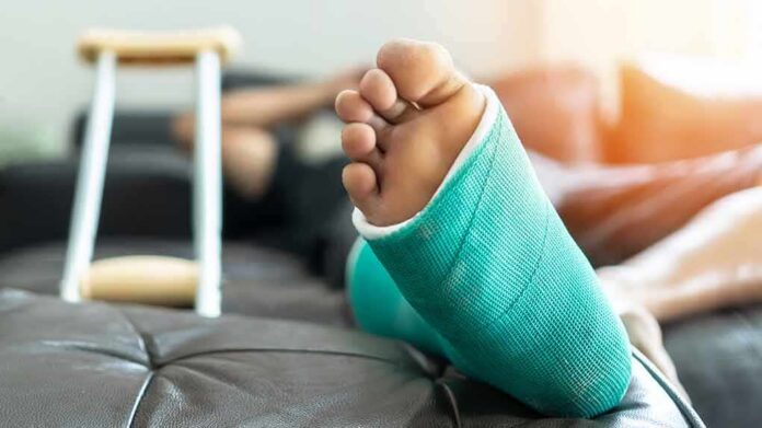 Injured foot in a turquoise cast resting on a couch